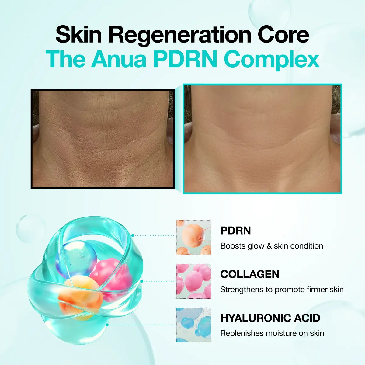 [Anua Official Shop] PDRN Hyaluronic Acid 100 Moisturizing Cream (60Ml) | Moisturizer, Hydrating, Glow, Korean Glass Skin, Korean Skincare, Collagen, Lightweight