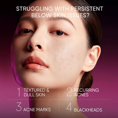[SKINTIFIC] 12% AHA BHA PHA LHA Peeling Solution, Glycolic Acid Acne Treatment for Face, Exfoliating Peeling Serum for Dull, Rough, Oily Skin with Clogged Pores & Dead Cells
