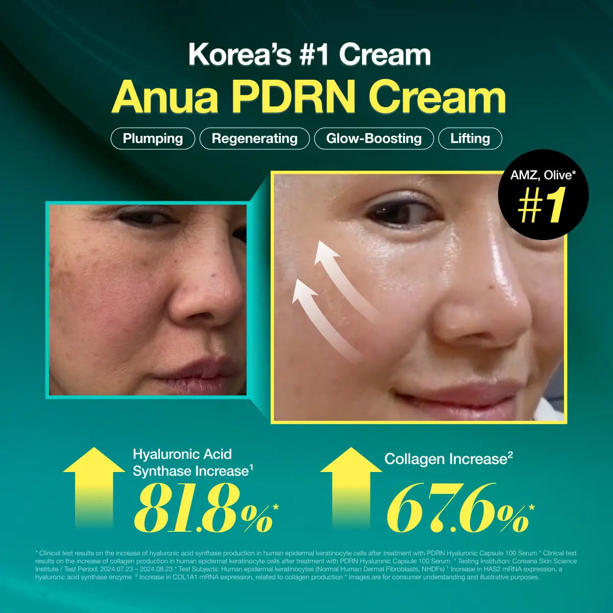 [Anua Official Shop] PDRN Hyaluronic Acid 100 Moisturizing Cream (60Ml) | Moisturizer, Hydrating, Glow, Korean Glass Skin, Korean Skincare, Collagen, Lightweight