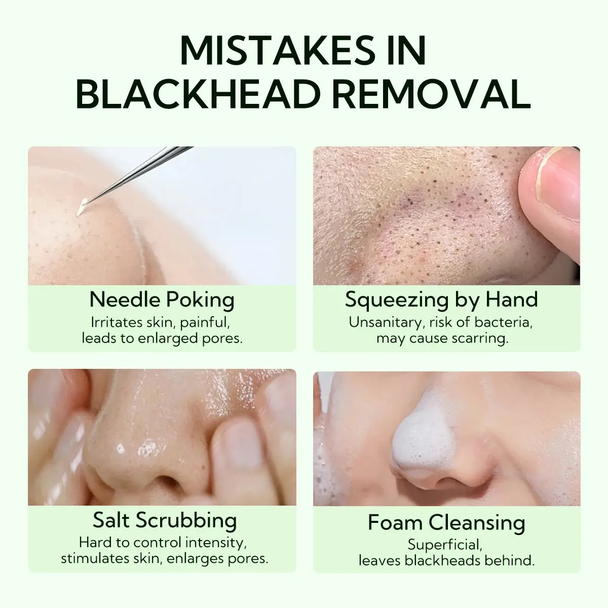 LANBENA Blackhead Remover Serum Shrink Pore Facial Serum Peeling off Mask Skincare Acne Treatment Essence 17Ml Comfort Skin Repair